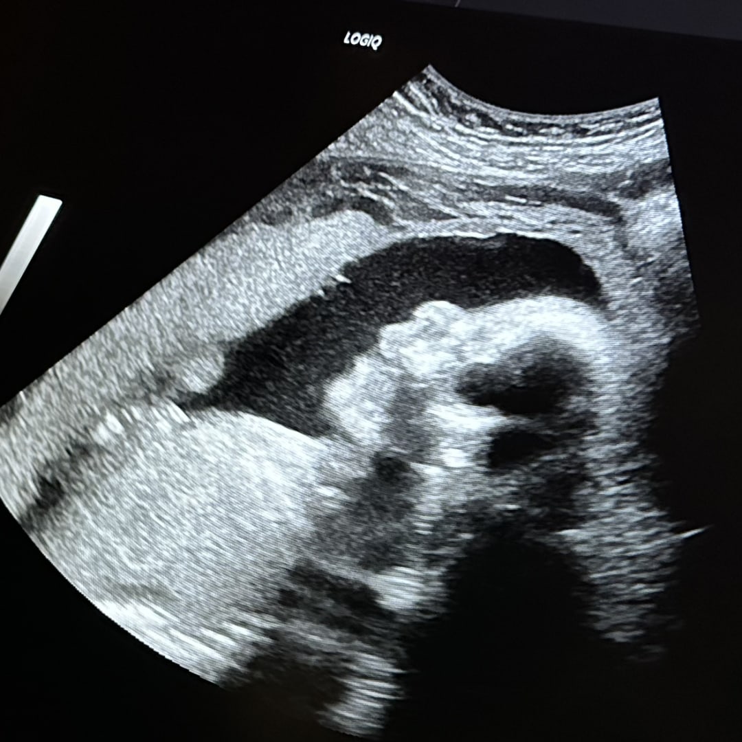 Photo shared by Kimberly for their Babylist baby registry.