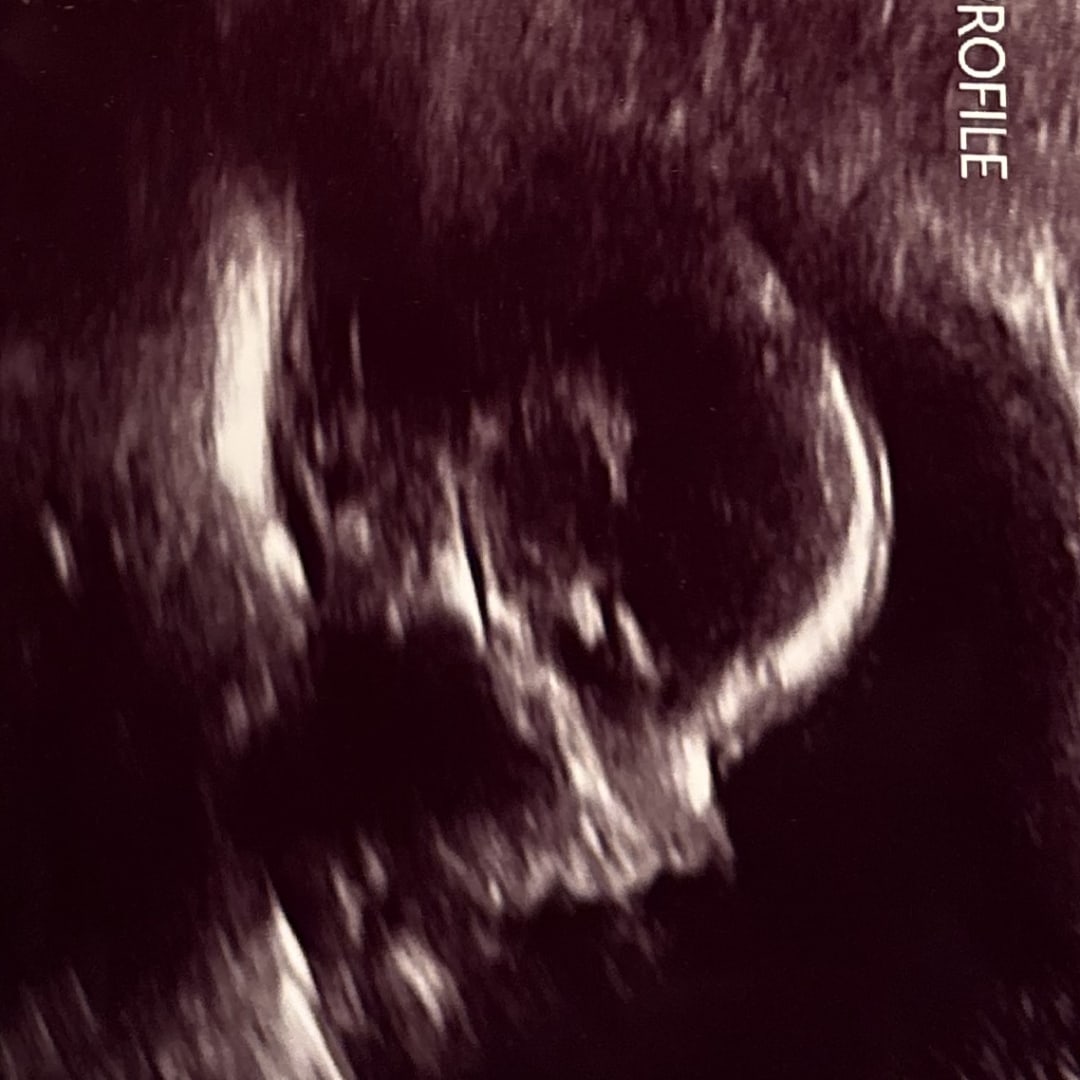 Photo shared by Melissa for their Babylist baby registry.