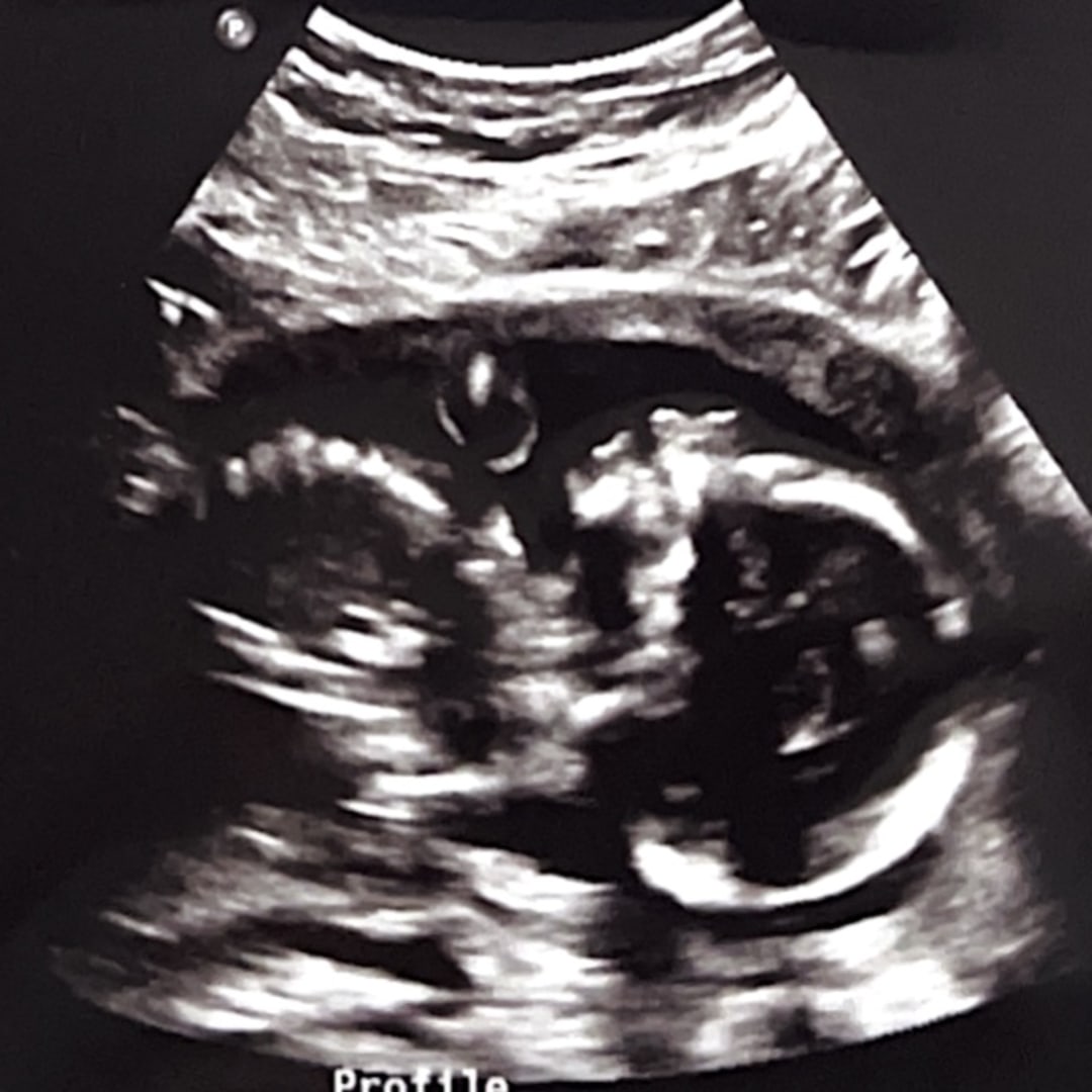 Photo shared by Kevin for their Babylist baby registry.