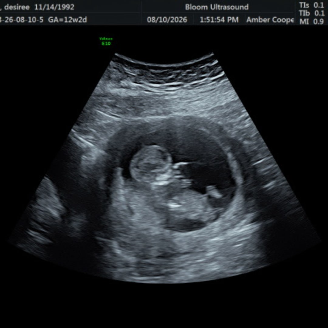 Photo shared by Desiree for their Babylist baby registry.