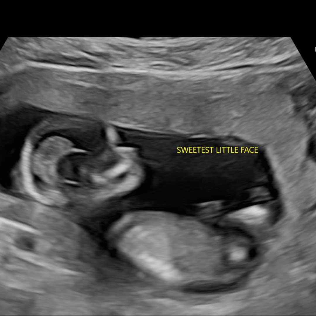 Photo shared by Jannette for their Babylist baby registry.