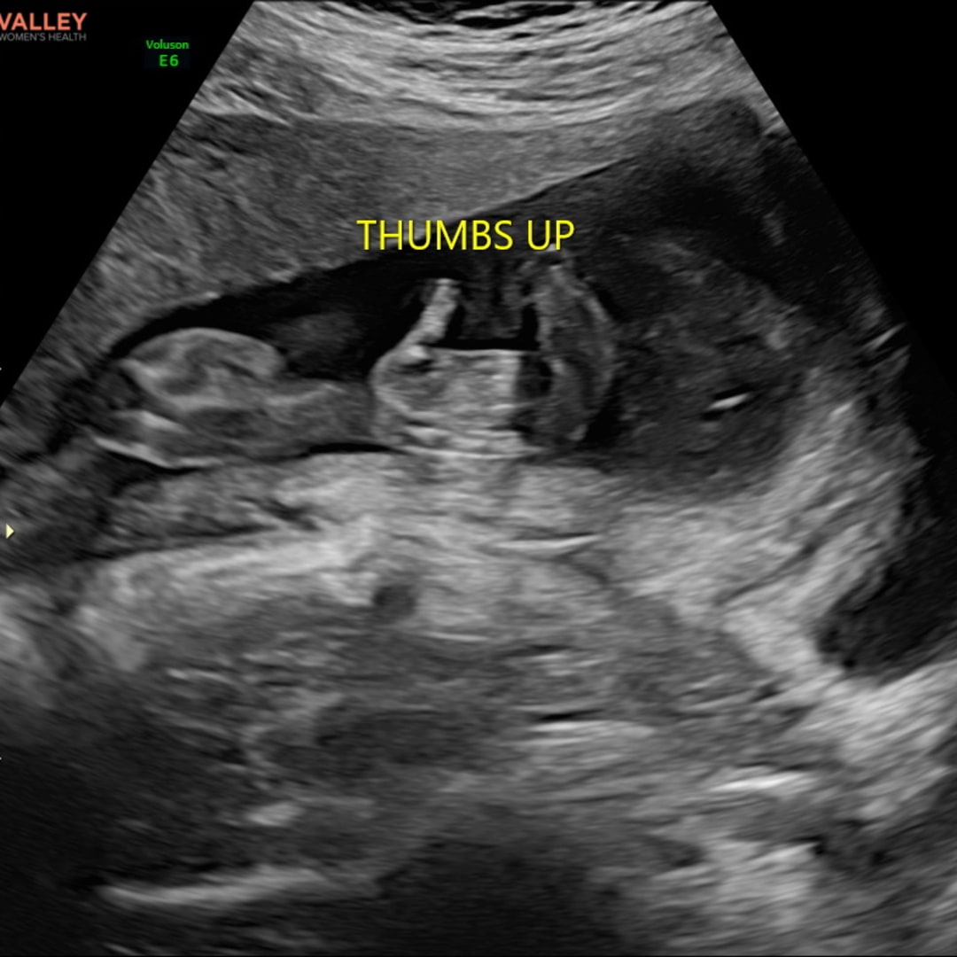 Photo shared by Brinlee for their Babylist baby registry.