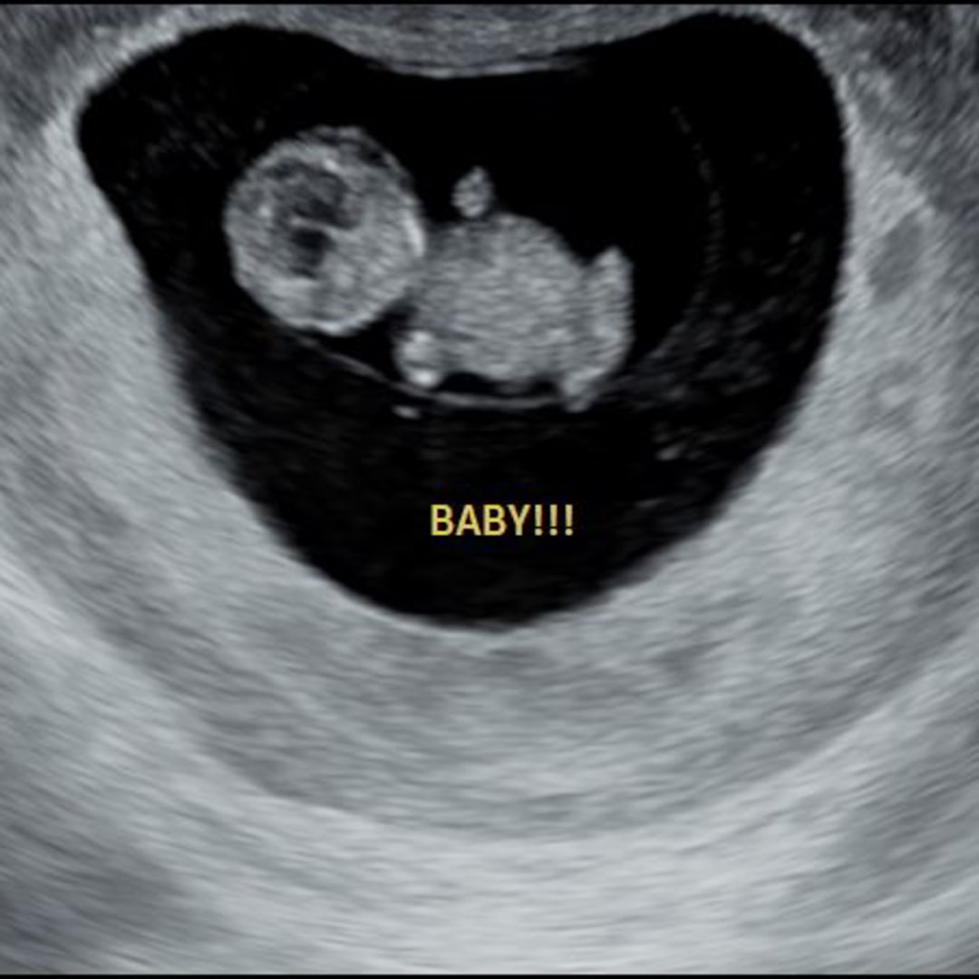 Photo shared by Candice for their Babylist baby registry.