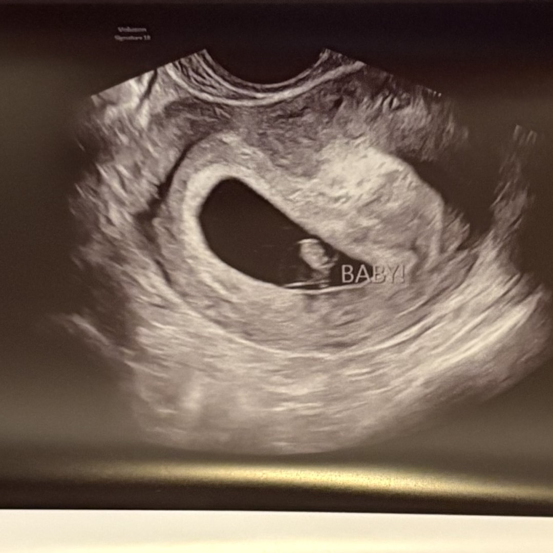 Photo shared by Gabby for their Babylist baby registry.