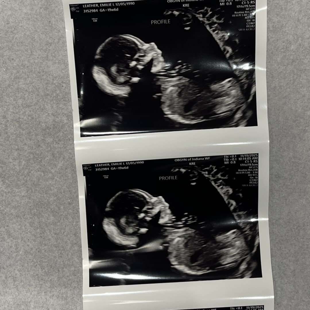 Photo shared by Emilie for their Babylist baby registry.