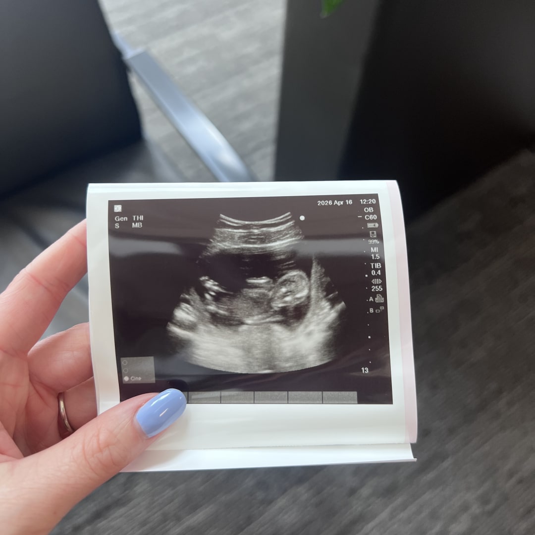 Photo shared by Rebecca for their Babylist baby registry.