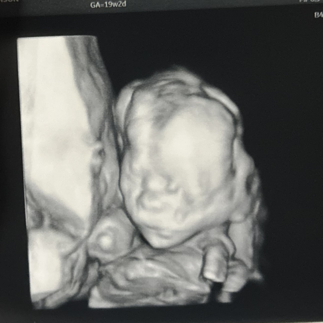 Photo shared by Madison for their Babylist baby registry.