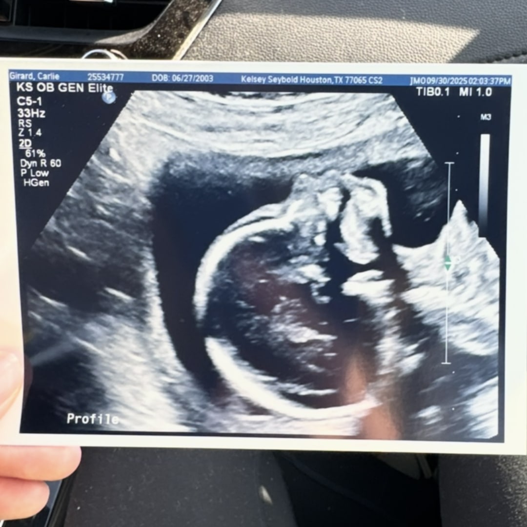 Photo shared by Carlie for their Babylist baby registry.