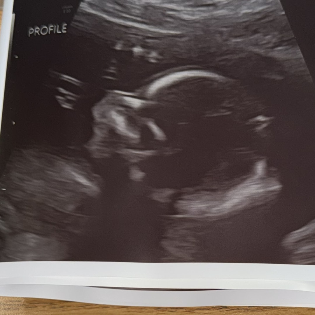 Photo shared by Sonia for their Babylist baby registry.