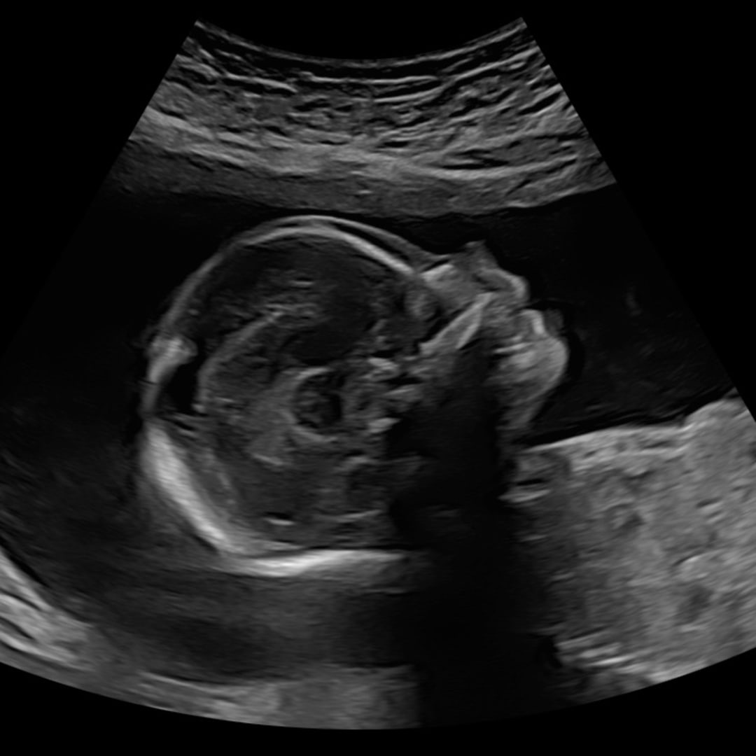 Photo shared by Alyson for their Babylist baby registry.