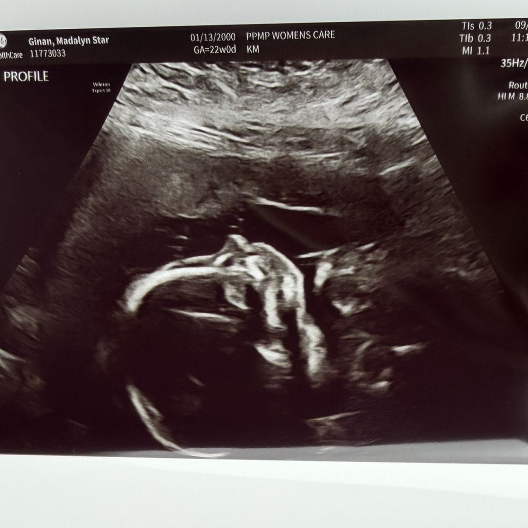 Photo shared by Madalyn for their Babylist baby registry.