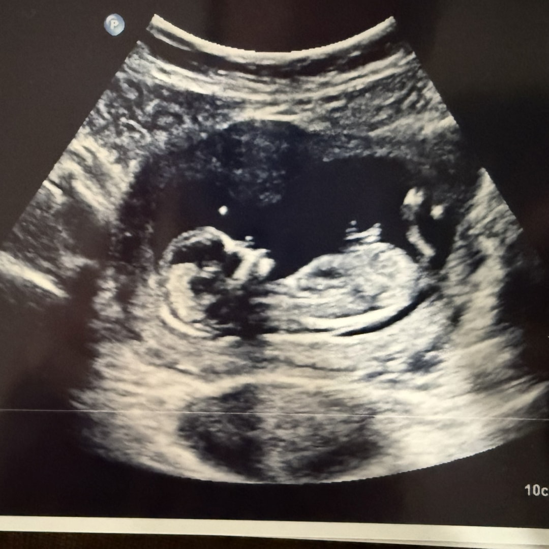 Photo shared by Yaquelin for their Babylist baby registry.