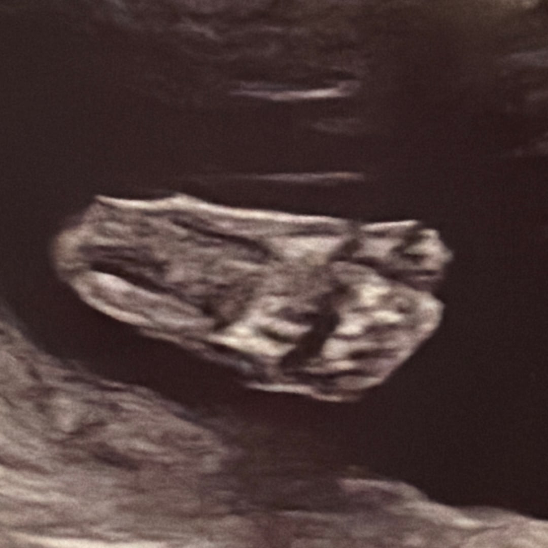 Photo shared by Ashley for their Babylist baby registry.