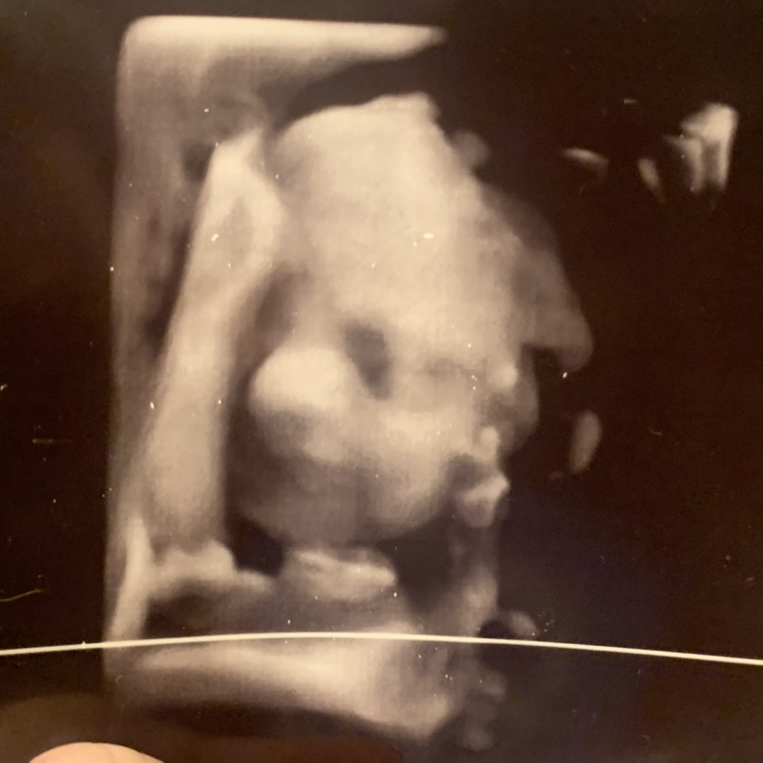 Photo shared by Taylor for their Babylist baby registry.