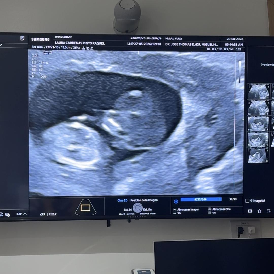 Photo shared by Laura for their Babylist baby registry.