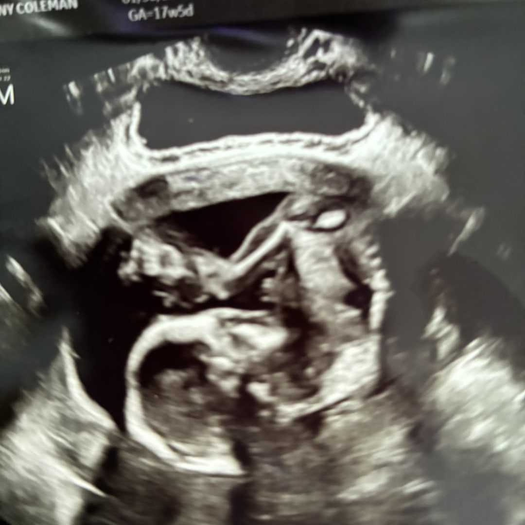 Photo shared by Destiny for their Babylist baby registry.