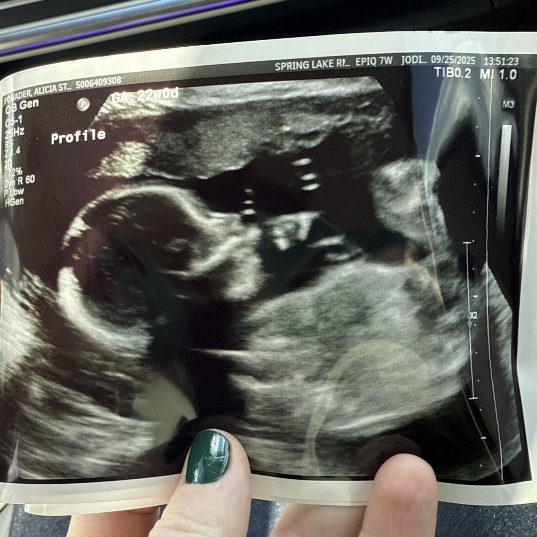 Photo shared by Alicia for their Babylist baby registry.