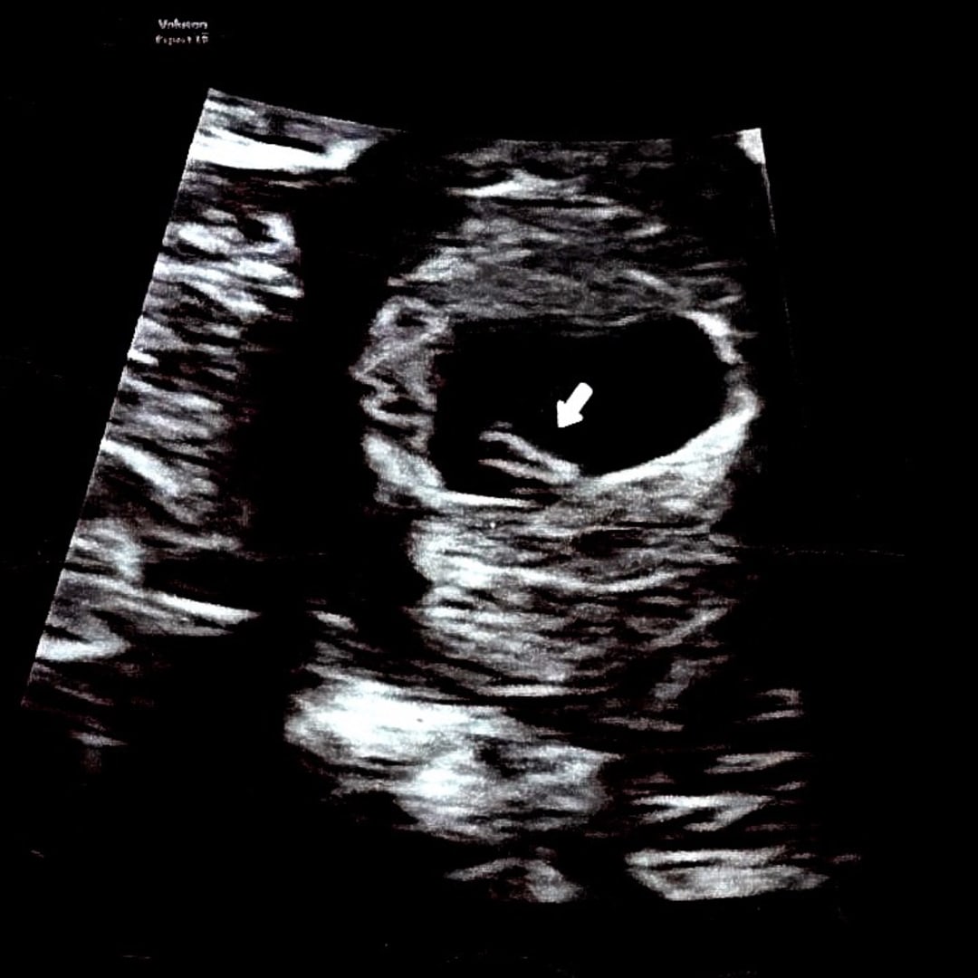 Photo shared by Karen for their Babylist baby registry.