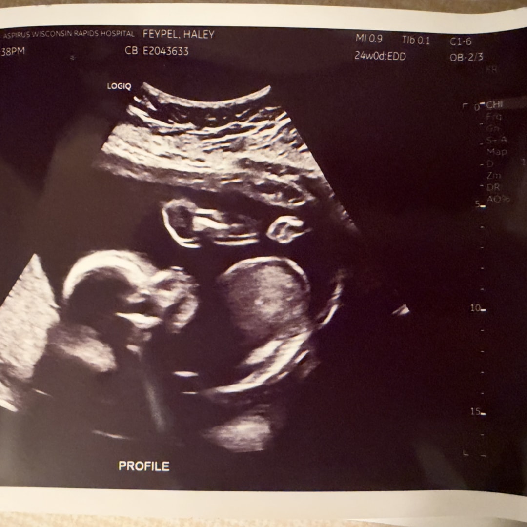 Photo shared by Haley for their Babylist baby registry.
