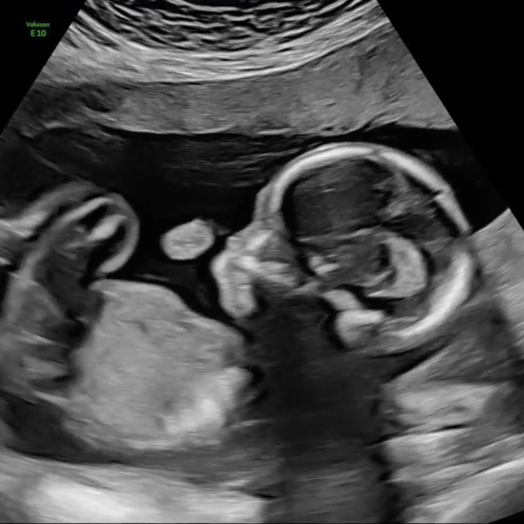 Photo shared by Bret for their Babylist baby registry.