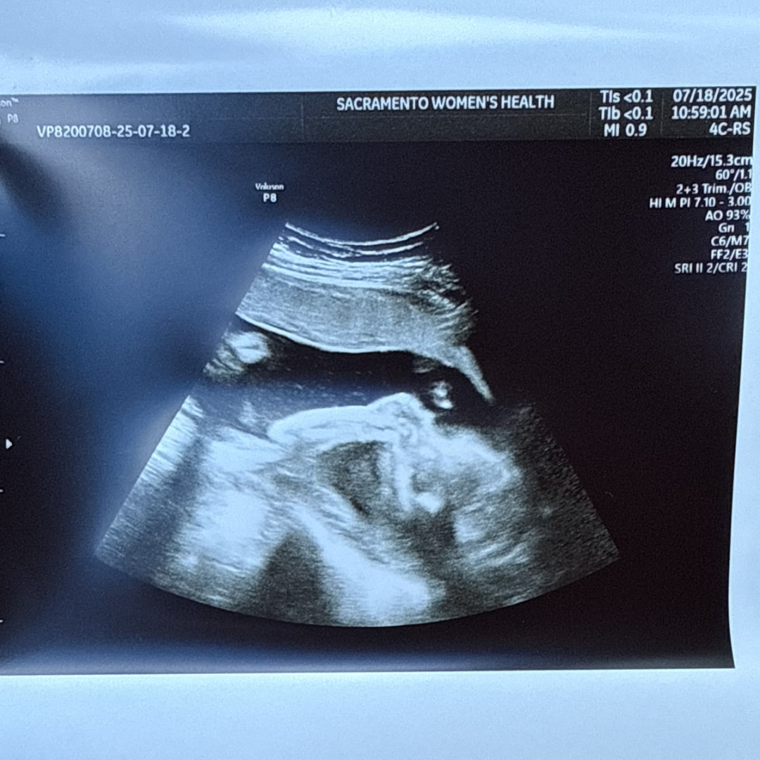 Photo shared by Hannah for their Babylist baby registry.