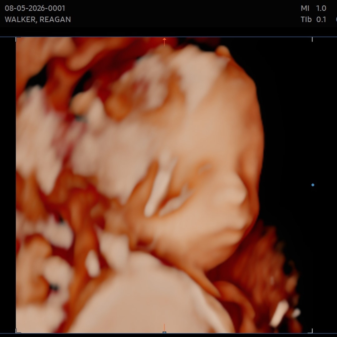 Photo shared by Reagan for their Babylist baby registry.