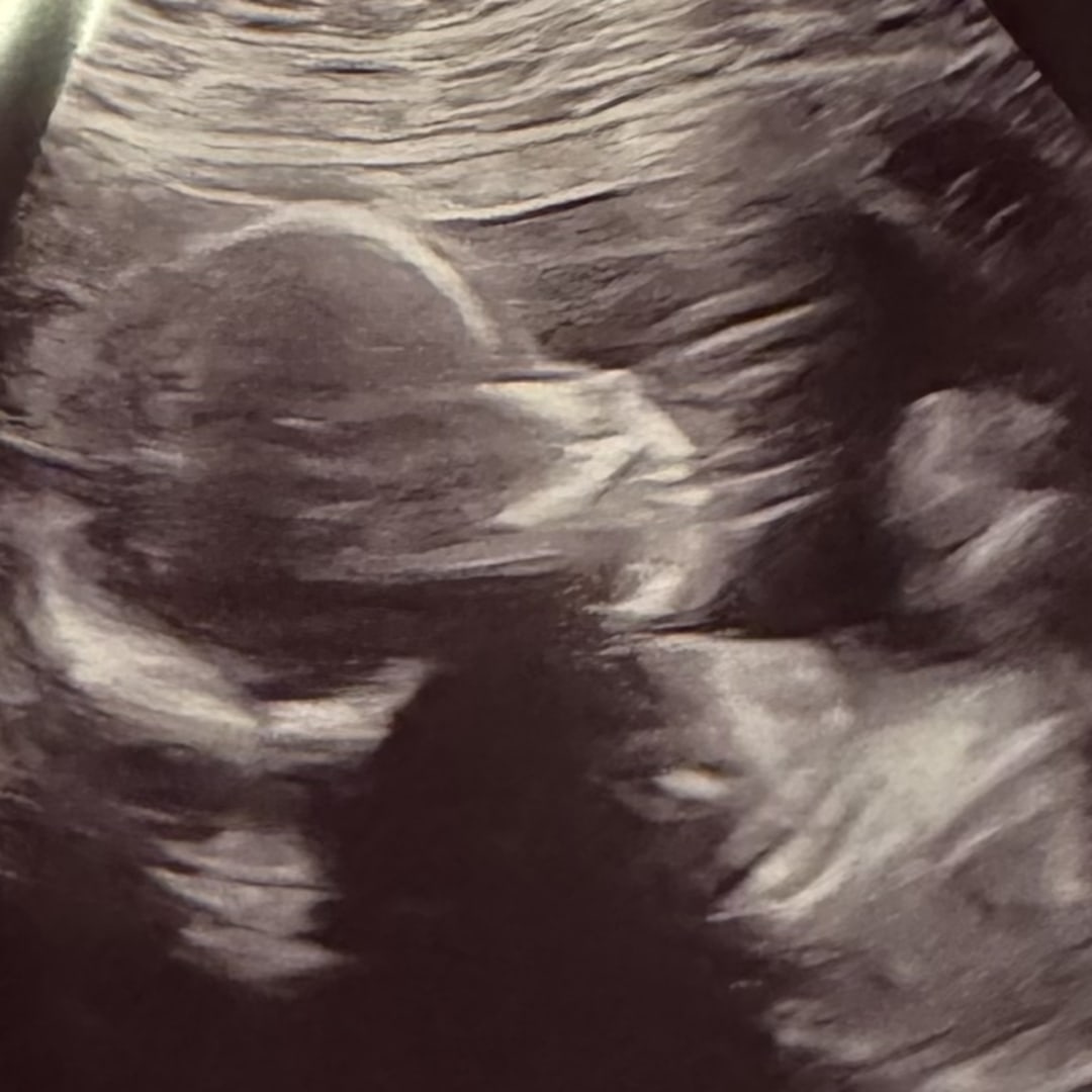 Photo shared by Alyssa for their Babylist baby registry.