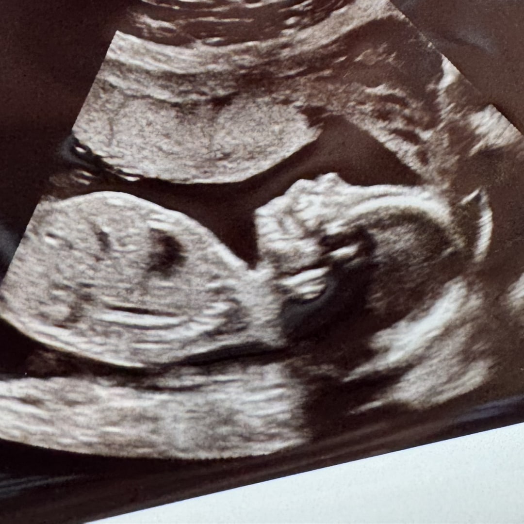 Photo shared by Nicole for their Babylist baby registry.