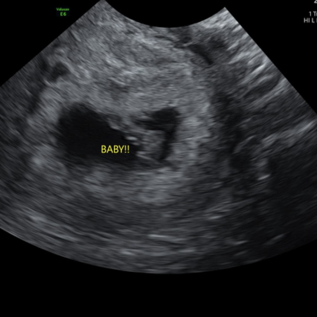 Photo shared by Joanne for their Babylist baby registry.