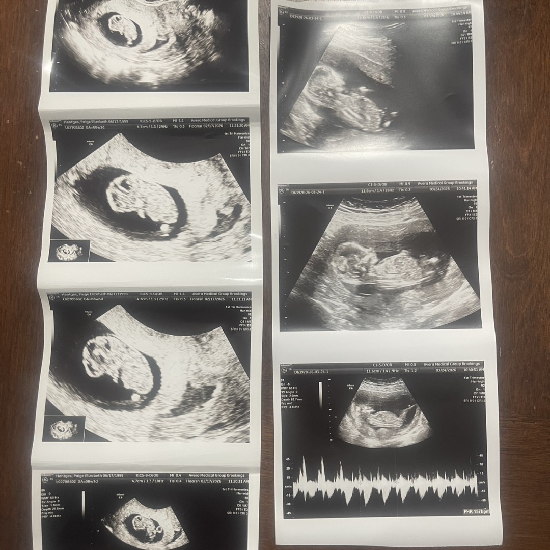 Photo shared by Paige for their Babylist baby registry.