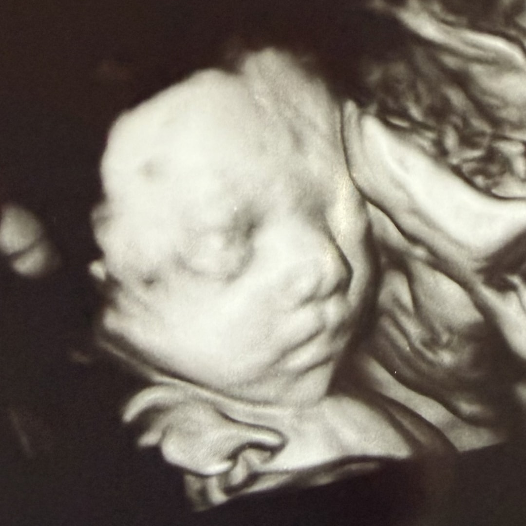 Photo shared by Emily for their Babylist baby registry.