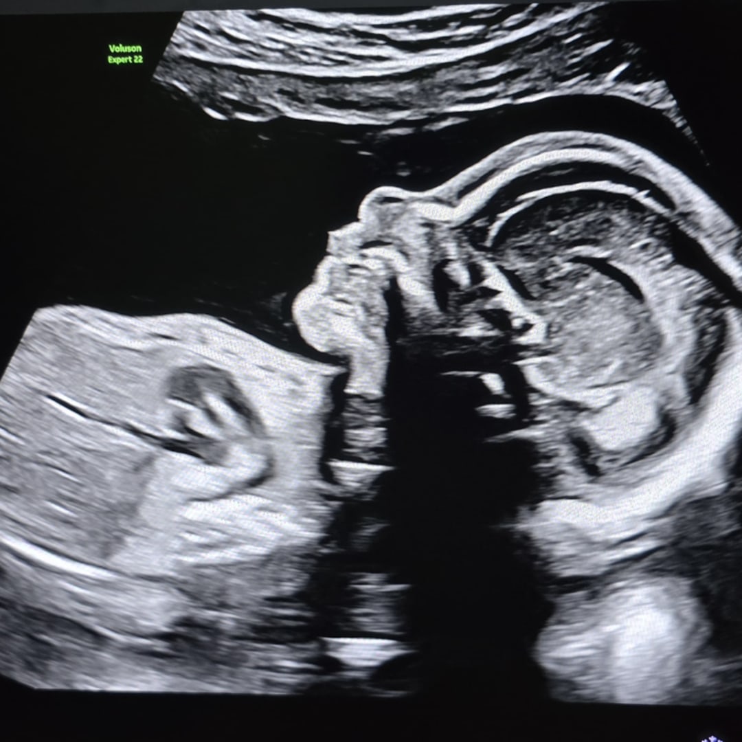 Photo shared by Harriet for their Babylist baby registry.
