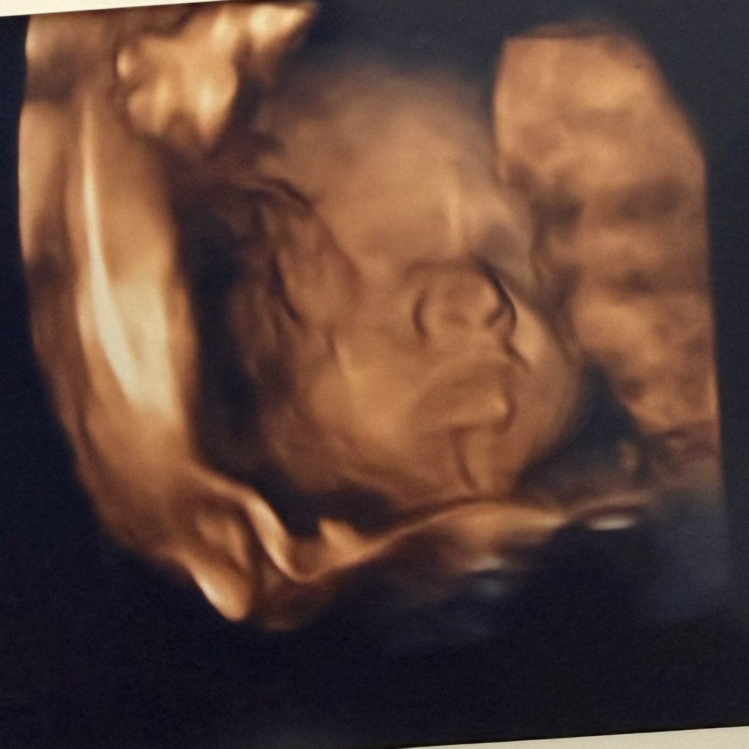 Photo shared by Mya for their Babylist baby registry.