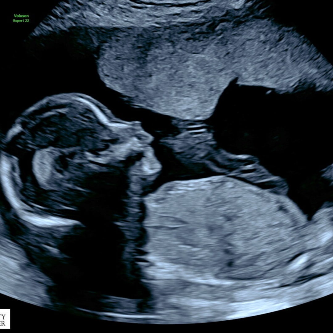 Photo shared by Brianna for their Babylist baby registry.