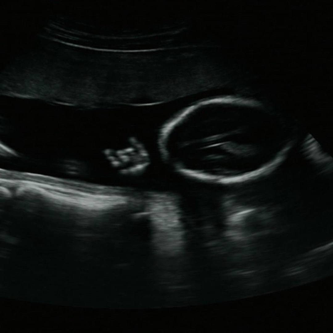 Photo shared by Allie for their Babylist baby registry.