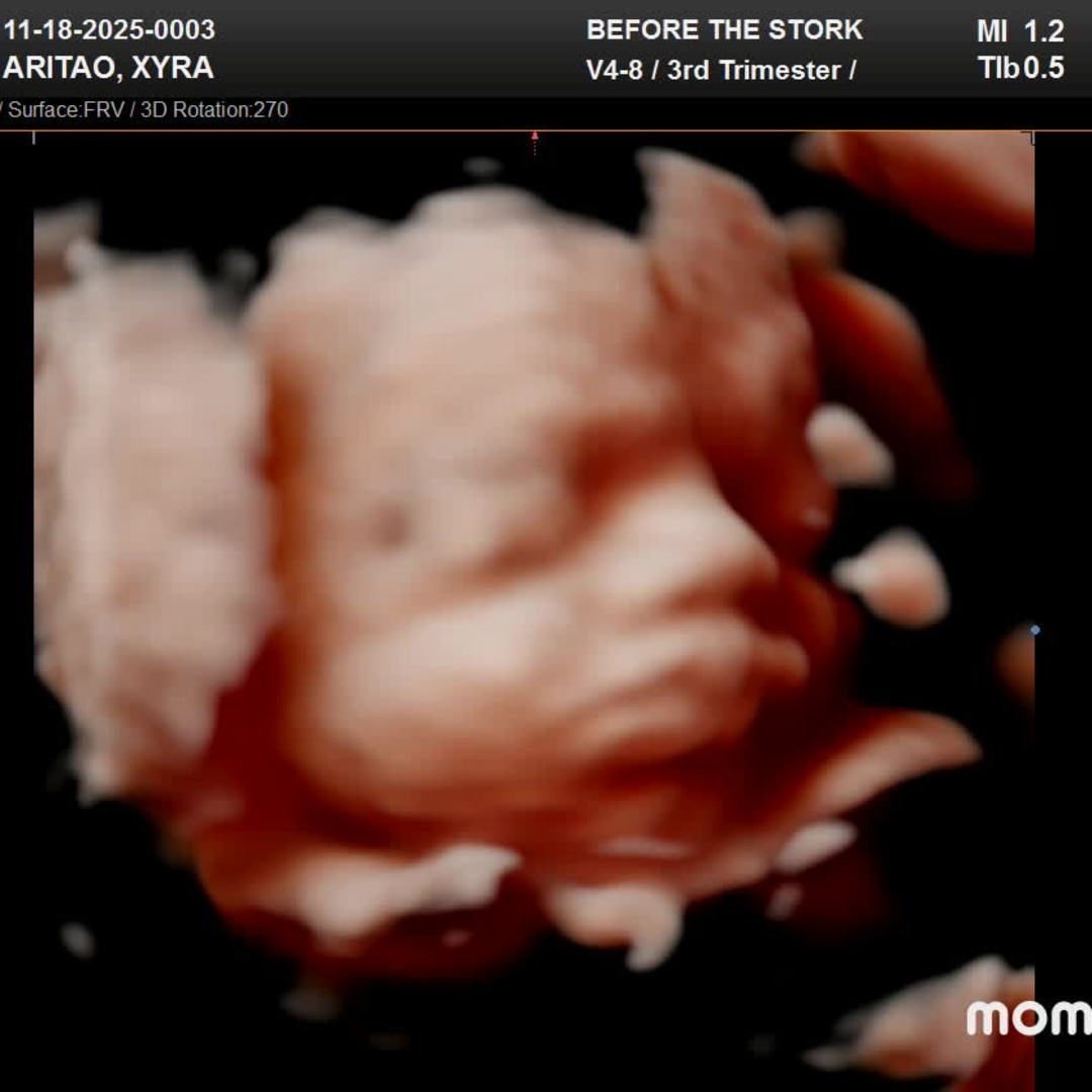 Photo shared by Xyra Lyn for their Babylist baby registry.