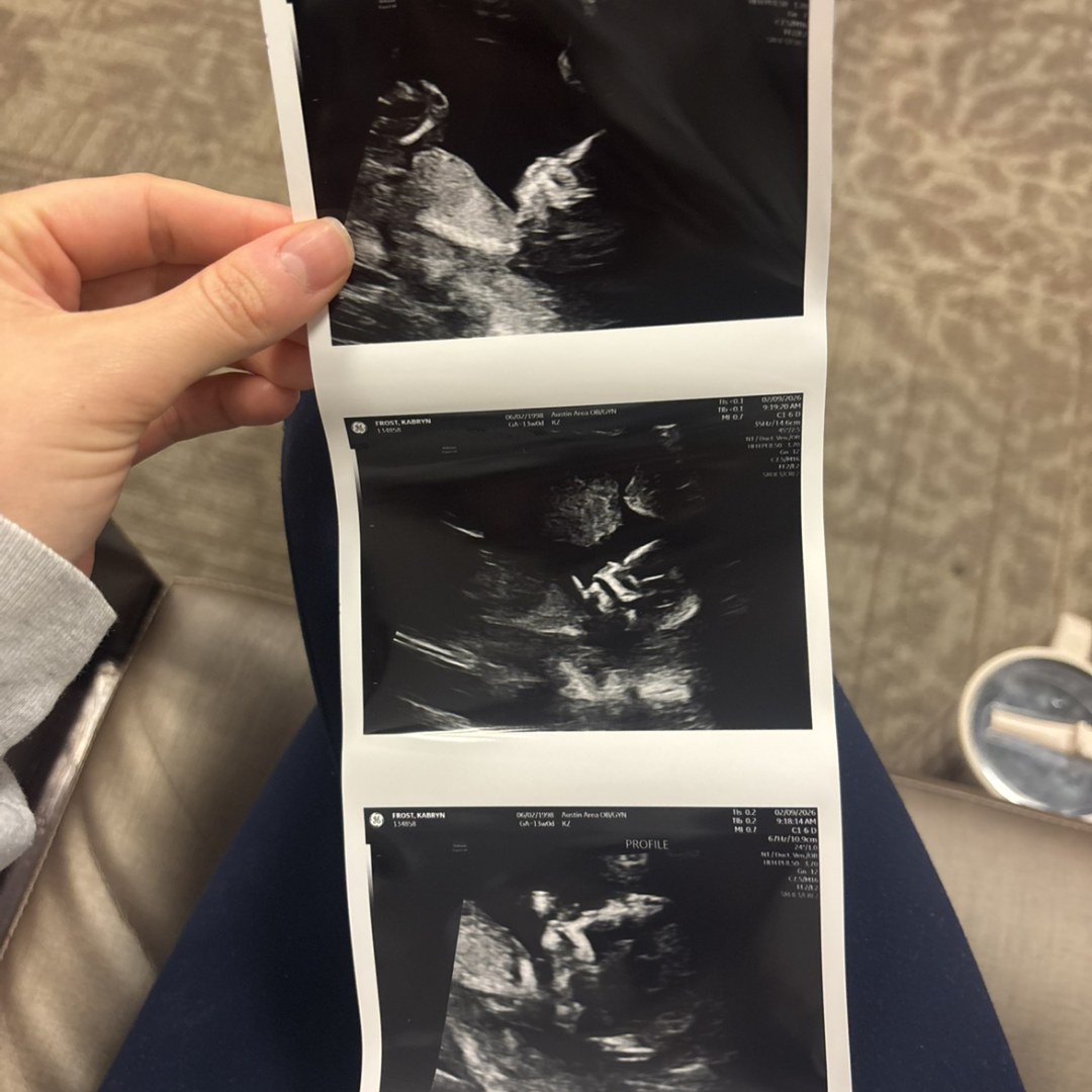 Photo shared by Kabryn for their Babylist baby registry.