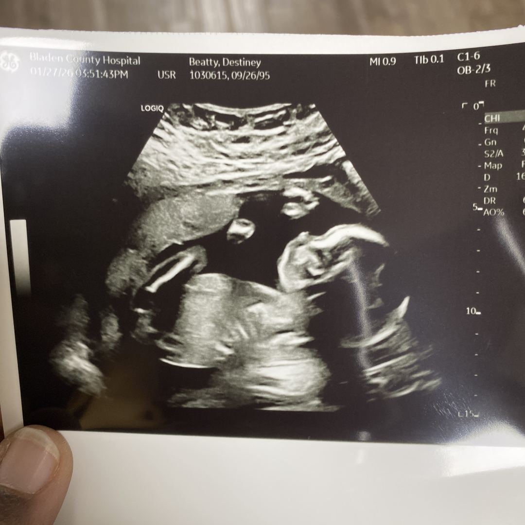 Photo shared by Destiney for their Babylist baby registry.