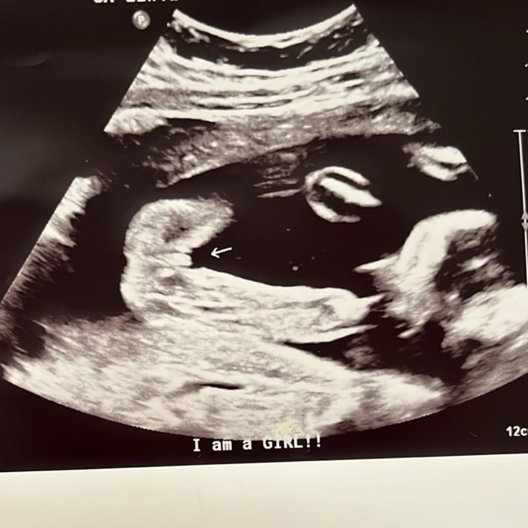 Photo shared by Shannel for their Babylist baby registry.