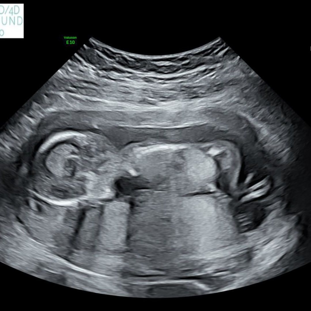 Photo shared by Shaylynn for their Babylist baby registry.