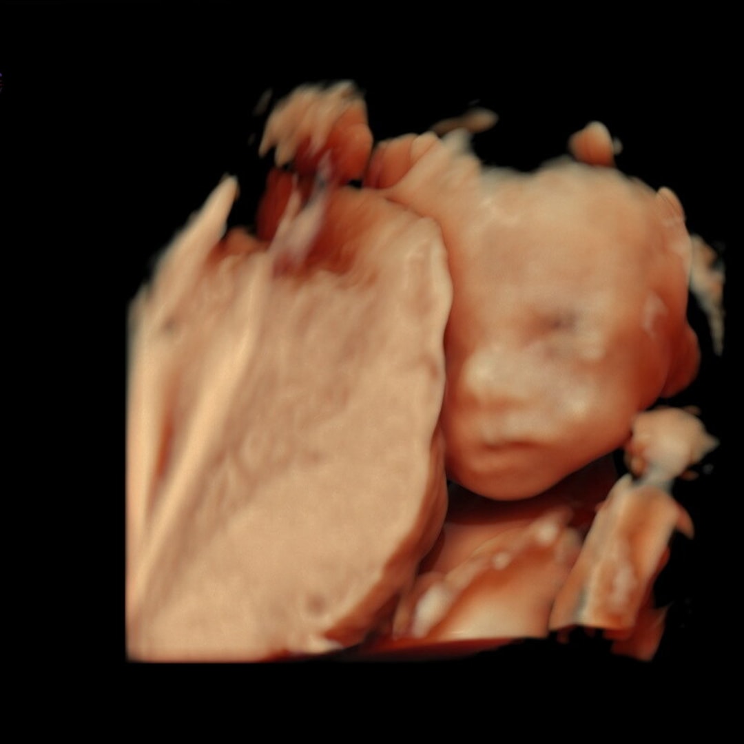 Photo shared by Skyla for their Babylist baby registry.