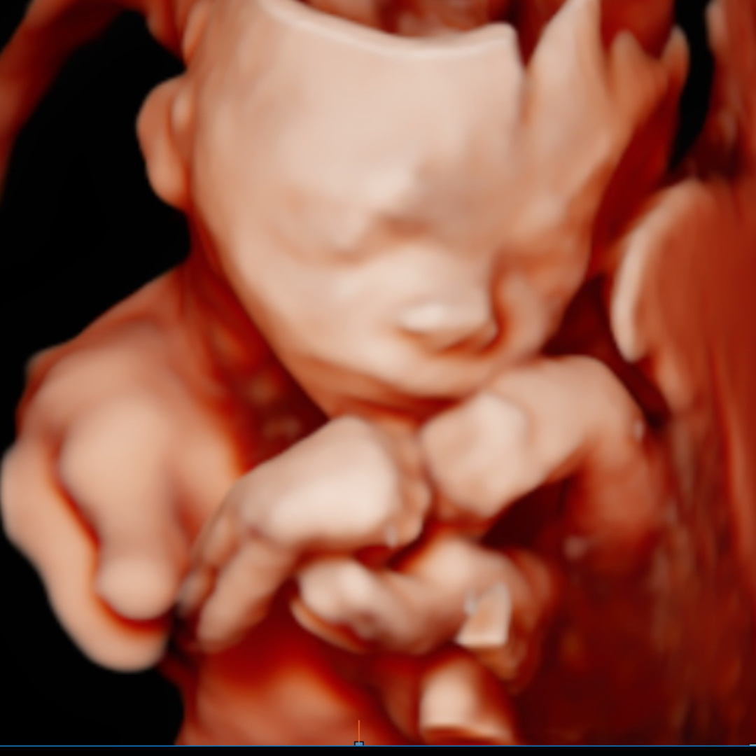 Photo shared by Kayla for their Babylist baby registry.