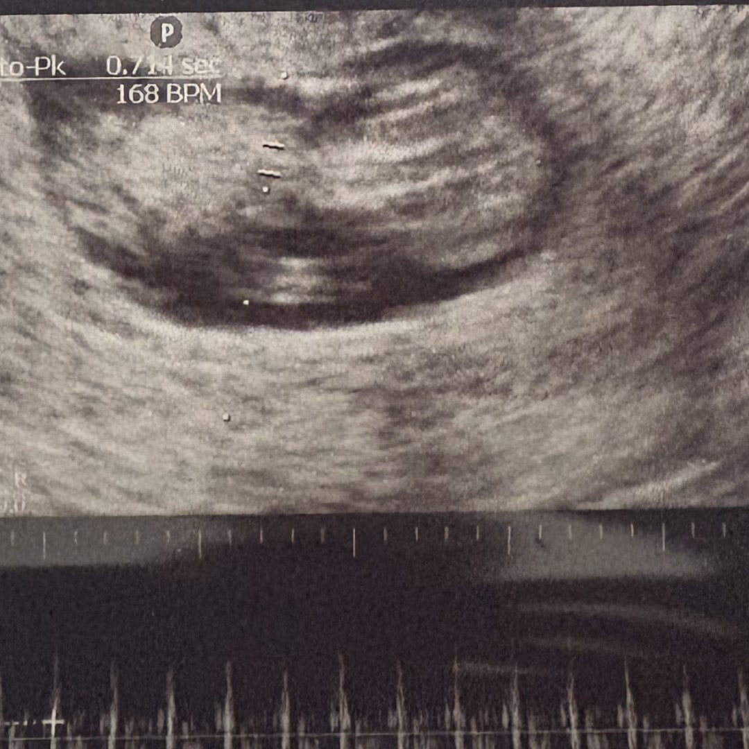 Photo shared by Amirah for their Babylist baby registry.