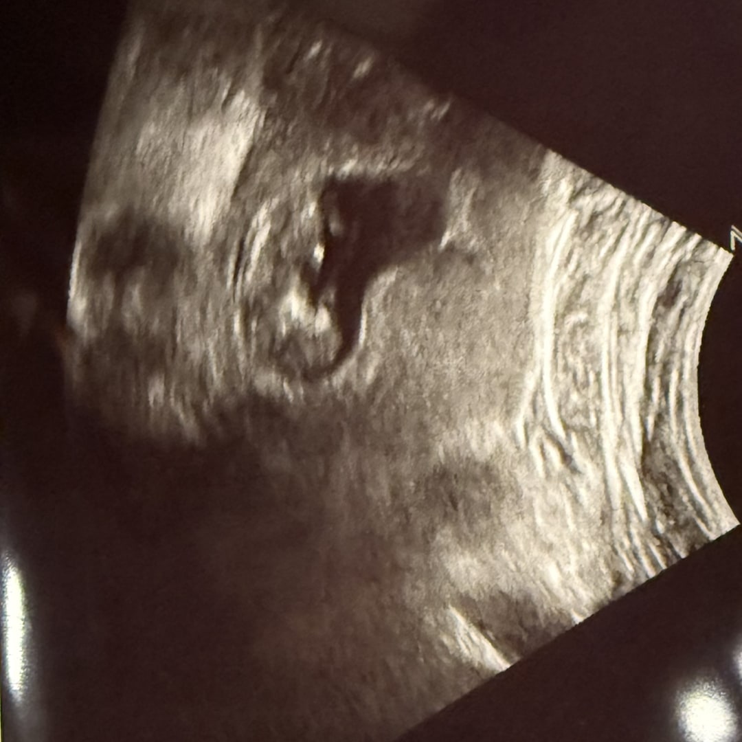 Photo shared by Alina for their Babylist baby registry.