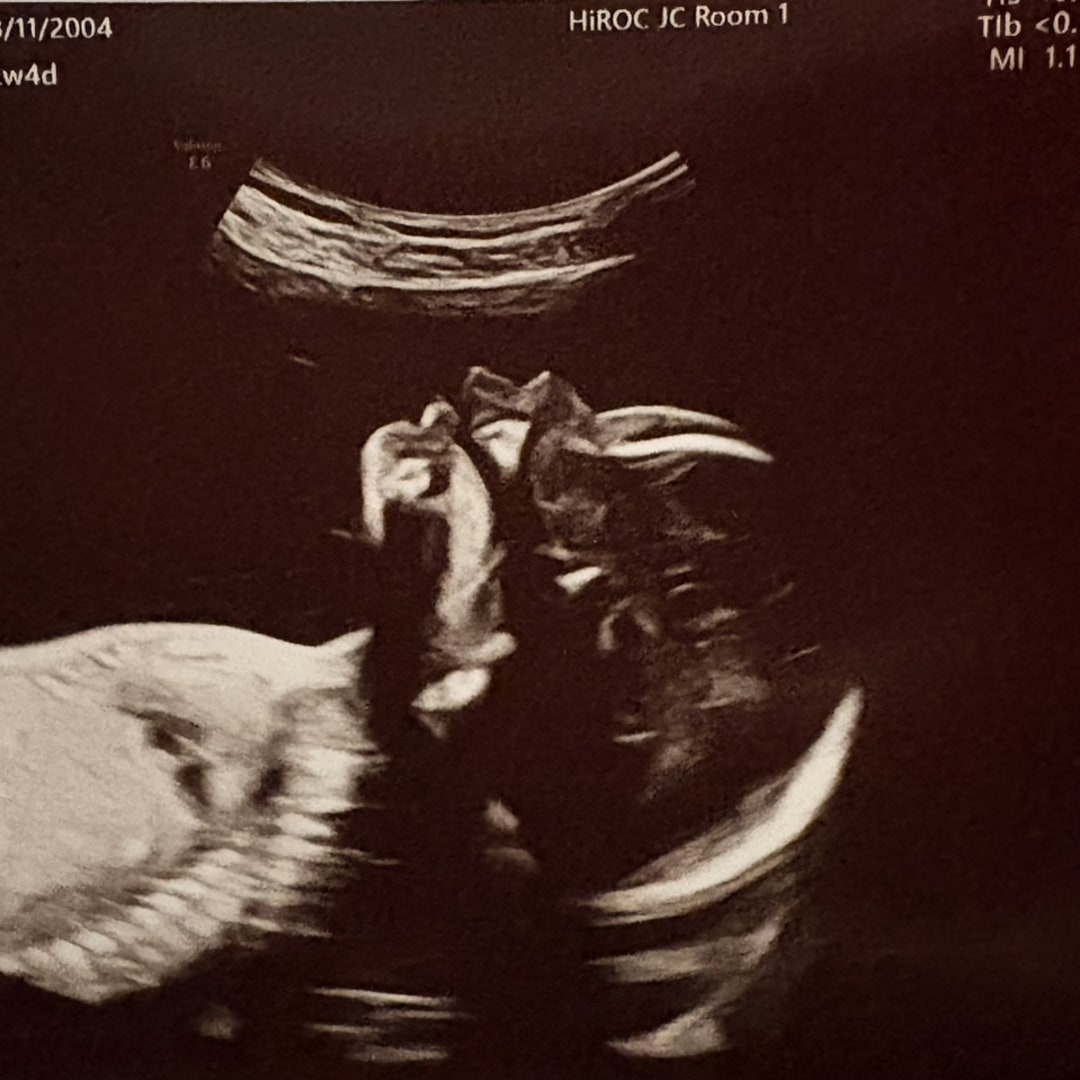 Photo shared by Emily for their Babylist baby registry.