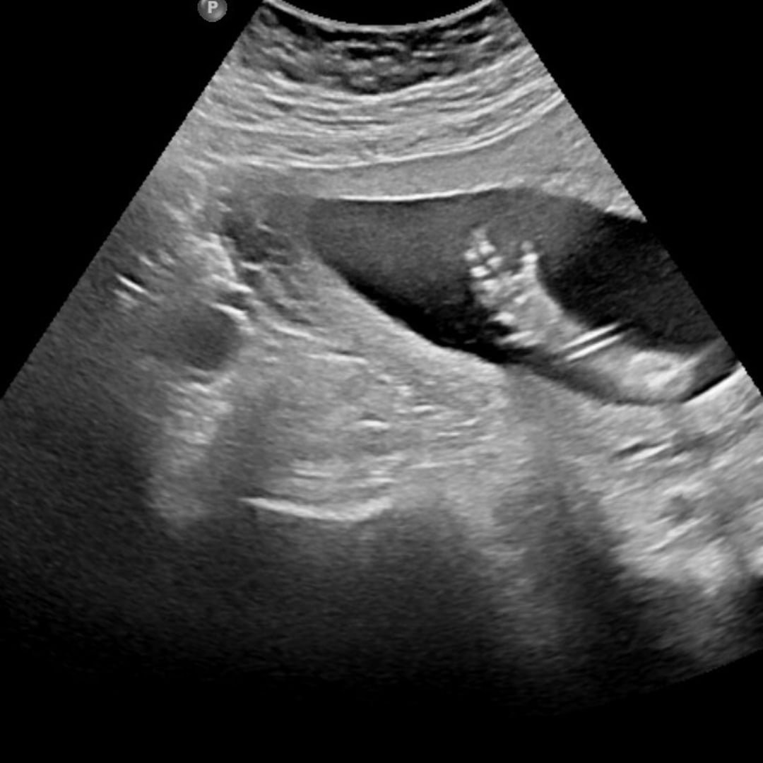 Photo shared by Brittney for their Babylist baby registry.