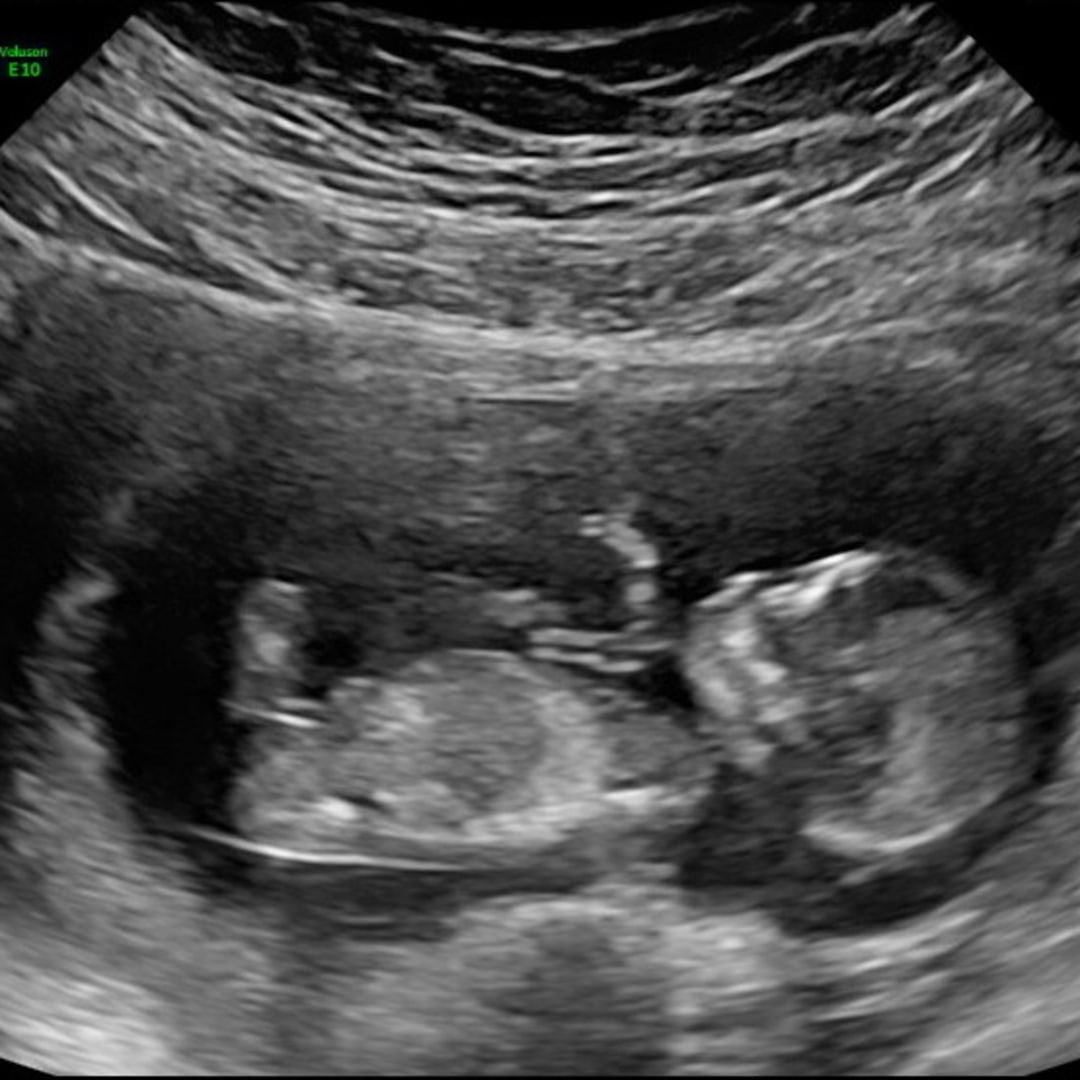 Photo shared by Anisha for their Babylist baby registry.