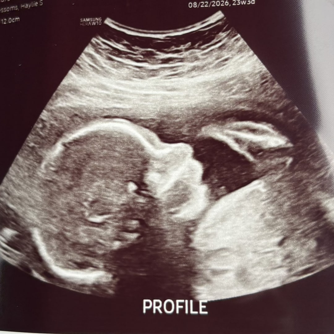 Photo shared by Haylie for their Babylist baby registry.