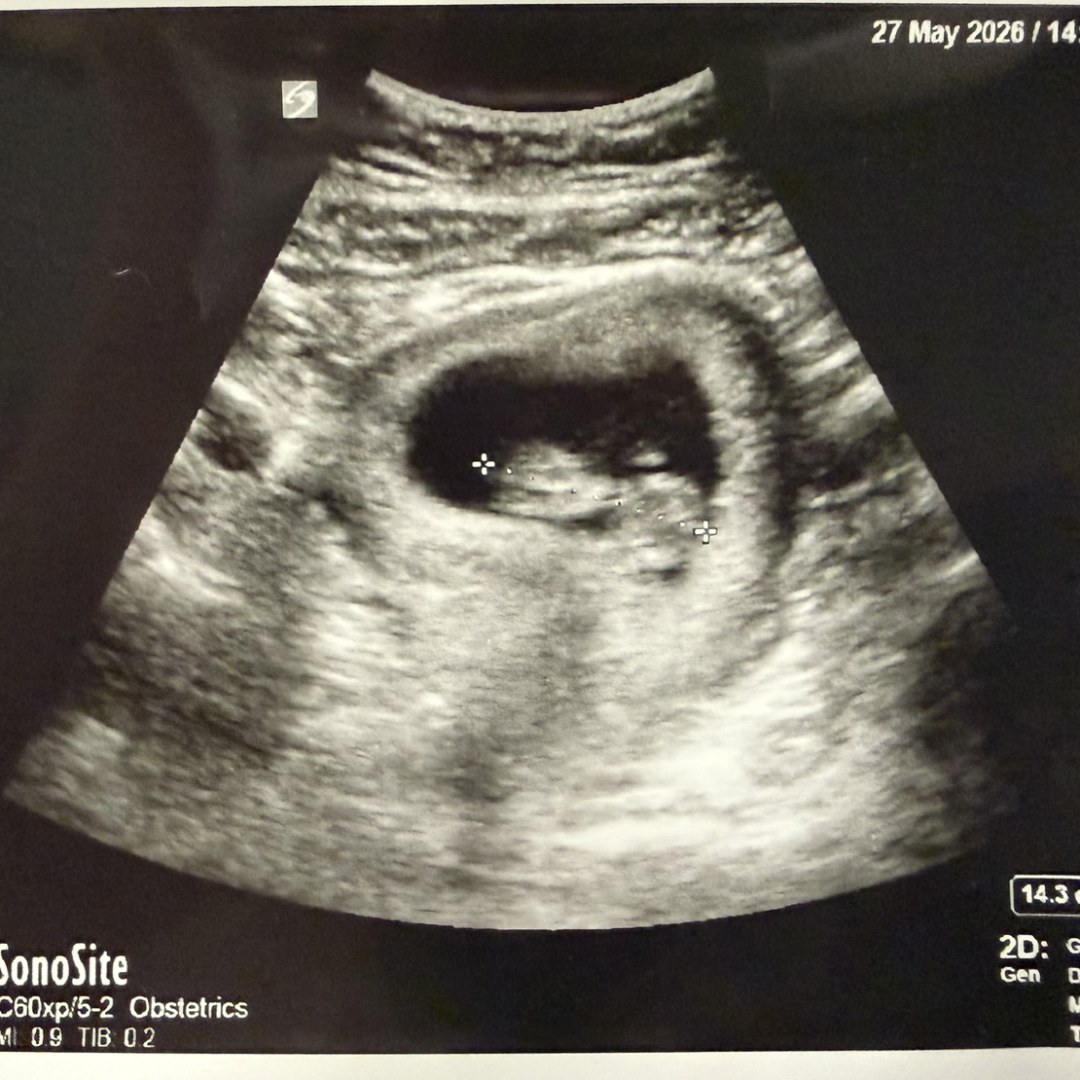 Photo shared by Jessica for their Babylist baby registry.