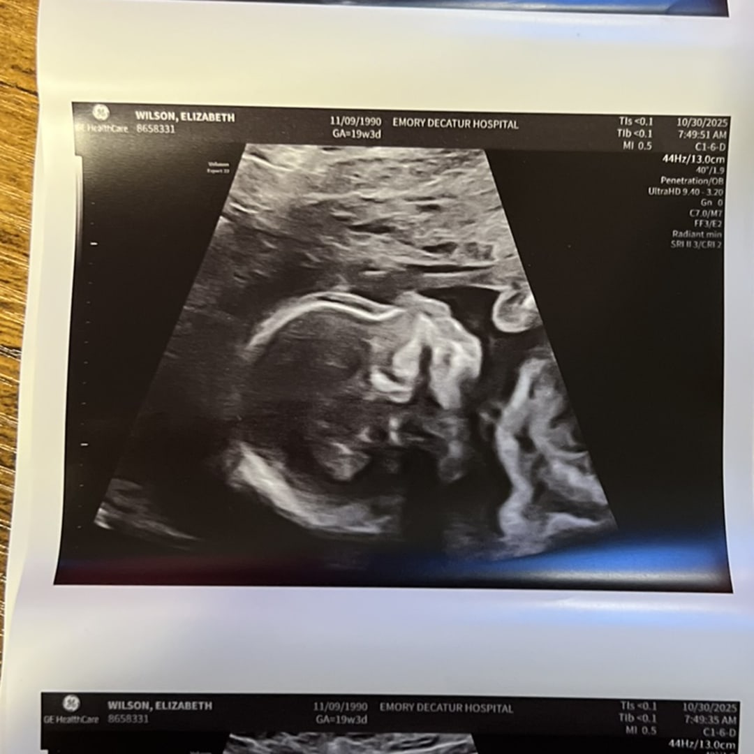 Photo shared by Elizabeth for their Babylist baby registry.